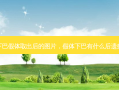 下巴假体取出后的图片，假体下巴有什么后遗症