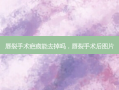 唇裂手术疤痕能去掉吗，唇裂手术后图片