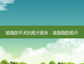 抽脂肪手术的图片图库，抽脂脂肪图片