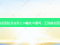 正规植发医院直咨新生3d植发有用吗，正规植发医院排名