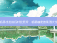 明星植发前后对比照片，明星植发效果图大全