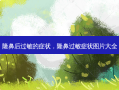 隆鼻后过敏的症状，隆鼻过敏症状图片大全