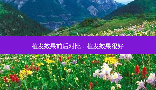 植发效果前后对比,植发效果很好-第1张图片-美和整形网 植发效果前后对比,植发效果很好-第1张图片-美和整形网