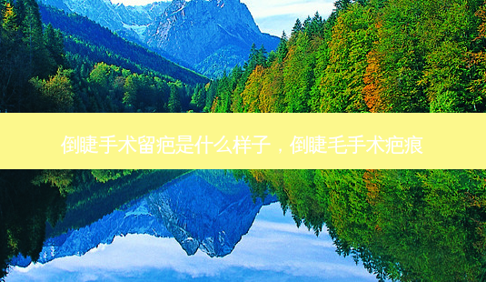 倒睫手术留疤是什么样子,倒睫毛手术疤痕-第1张图片-美和整形网 倒睫手术留疤是什么样子,倒睫毛手术疤痕-第1张图片-美和整形网