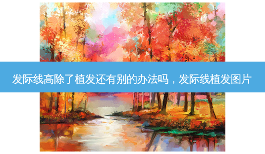 发际线高除了植发还有别的办法吗,发际线植发图片-第1张图片-美和整形网 发际线高除了植发还有别的办法吗,发际线植发图片-第1张图片-美和整形网